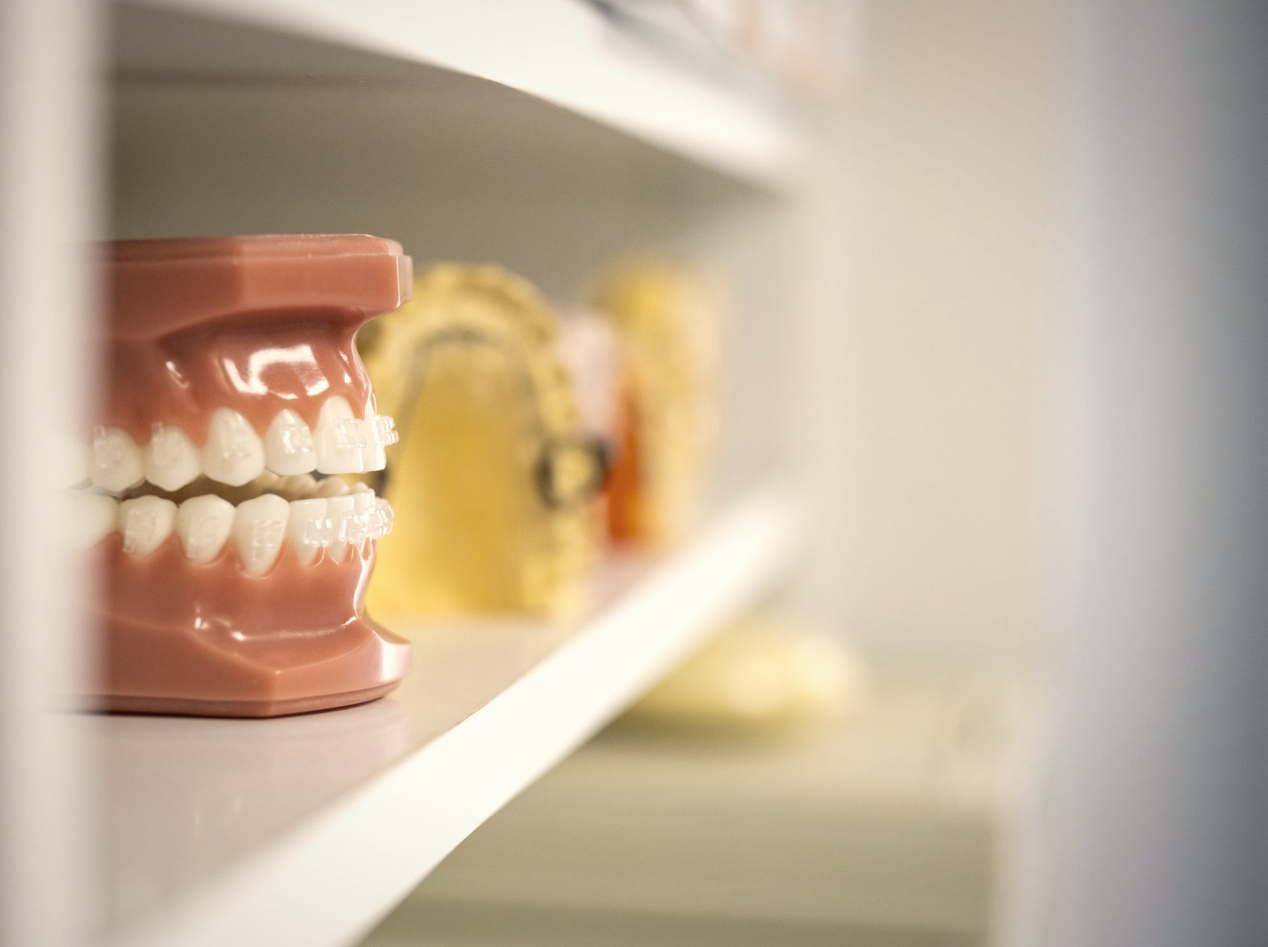 Modelo de ortodoncia con brackets en una estantería